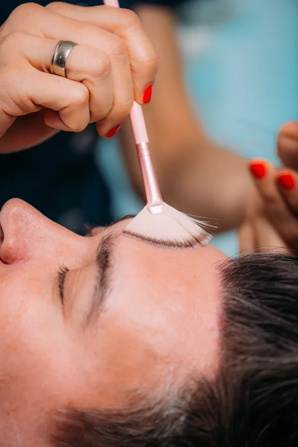 Close-up of a man receiving a chemical peel treatment on his forehead from professional who work with Yashoda Singh, MD on Hamilton-Toronto-Niagara.