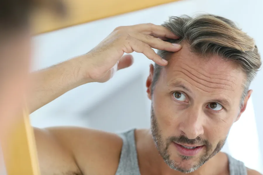 A middle-aged man looks in the mirror, worried about his hairline. Schedule hair restoration treatments from Yashoda Singh, MD in Hamilton-Toronto-Niagara.