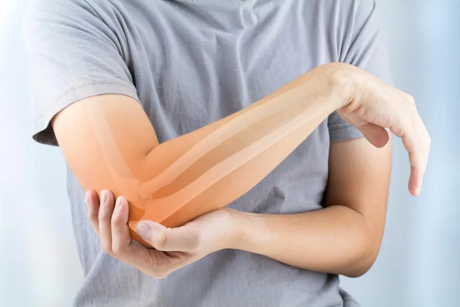 A close-up of a woman holding her elbow with an illustration of the bones and joint experiencing pain from osteoporosis. Get osteoporosis treatment from Yashoda Singh, MD in Hamilton-Toronto-Niagara.