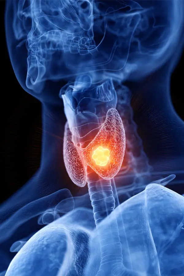 A 3D illustration of an x-ray of a human neck, highlighting the thyroid. Get help with thyroid imbalance from Yashoda Singh, MD in Hamilton-Toronto-Niagara.